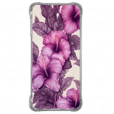 Capa Estampada Moto G31 - FL295